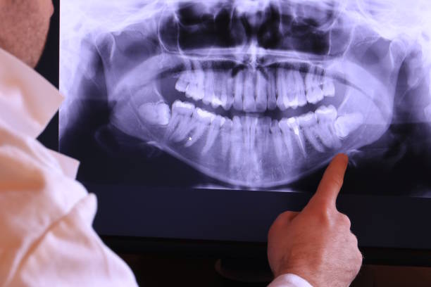 Best Emergency Root Canal Treatment in Maggie Valley, NC