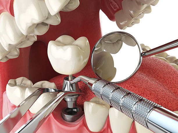 Fast & Reliable Emergency Dental Services in NC